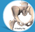 Anterior Hip video Demonstration